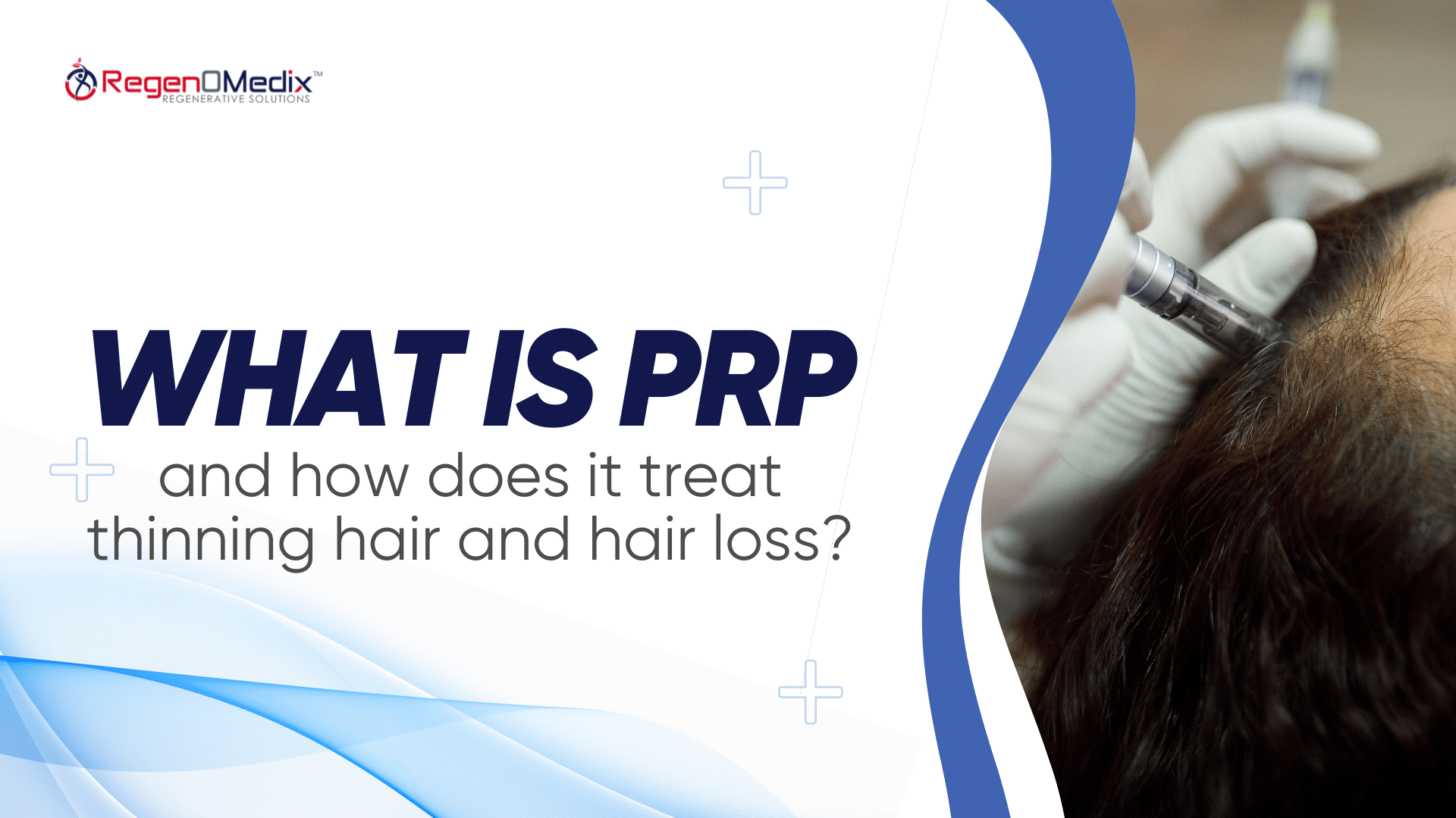 What is PRP and how does it treat thinning hair and hair loss