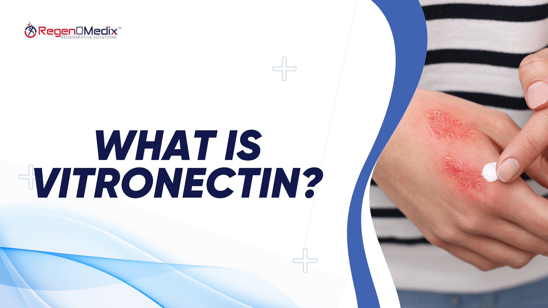 What is Vitronectin