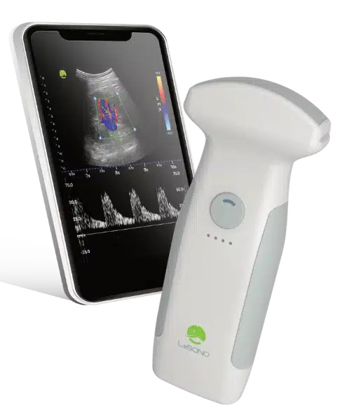 LeSONO_UltrasoundDevice