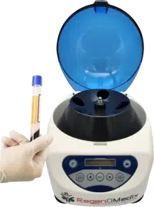 Centrifuge Machine with PRP tube