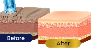 before-after-images-quonm45sq8mvd7v86jzta7pvo666mw992vpmq0oc40 (1)