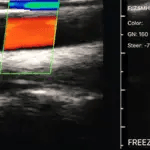 ultrasound-color-150×150