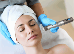 NanoPen Infuse device for targeted skin treatment and regenerative therapy
