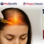 Platelet-rich plasma