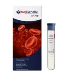 Platelet-rich plasma
