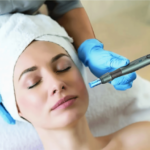 Platelet-rich plasma