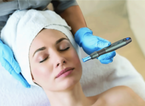 Platelet-rich plasma